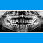 Radiografía panorámica que muestra la totalidad de las estructuras orales realizada en ortopantomógrafo.