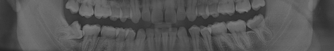 Otros servicios de odontología en Clínica Dental Ezedent