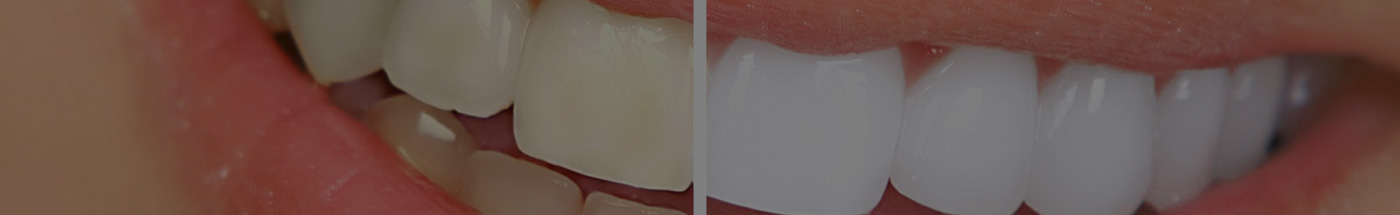 Tratamientos de odontología en Clínica Dental Ezedent